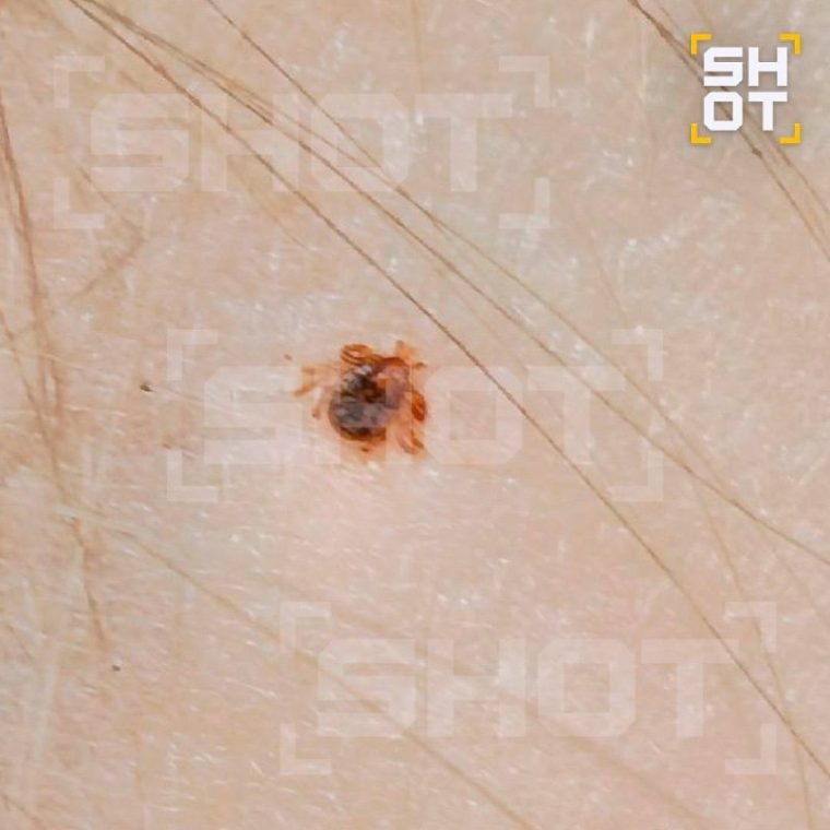 post-22476 thumbnail