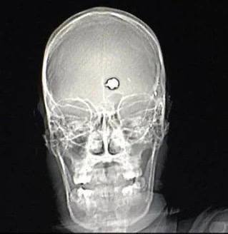 post-27873 thumbnail